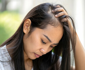 Fototapeta premium Young woman parting her hair to reveal thinning or hair loss