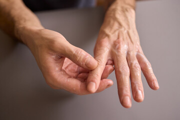 A gloved hand prepares to perform a care procedure safely and professionally in healthcare