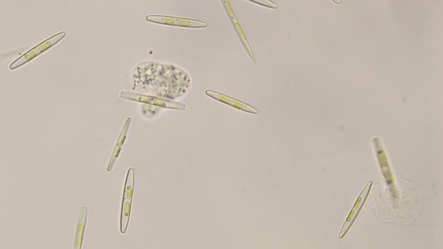 Freshwater Amoeba movement - Timelapse 10X speed