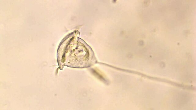 Vorticella sp under brightfield microscope - 400X