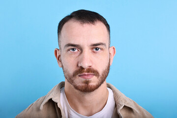 Fototapeta premium Baldness problem. Man with receding hairline on light blue background