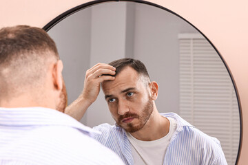 Obraz premium Baldness problem. Man with receding hairline near mirror in bathroom