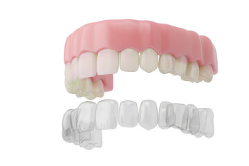 Healthy teeth with clear aligners on white background.