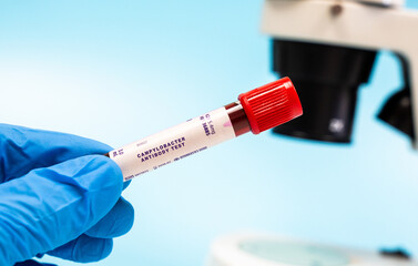 Identifies antibodies to Campylobacter species, indicating