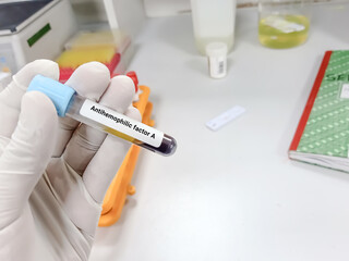 Scientist hold blood sample for Antihemophilic factor A Test. Healthcare and medical test concept.