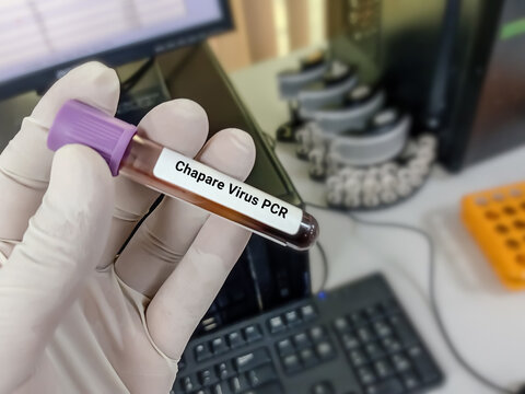 Scientist hold blood sample for Chapare virus PCR test. Healthcare and medical test concept.