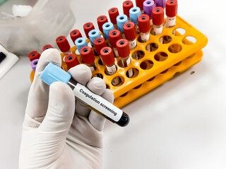 Scientist hold blood sample for Coagulation screening test. Healthcare and medical test concept.