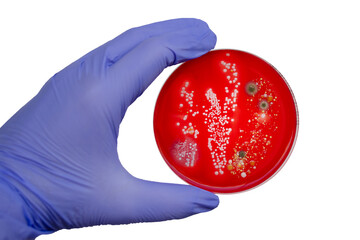 Fototapeta premium Bacterial and mold fungi colonies grown from indoor air on blood sheep agar