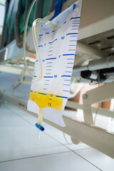 Urinary catheter measurement bag hung on the side of patient bed in hospital ward