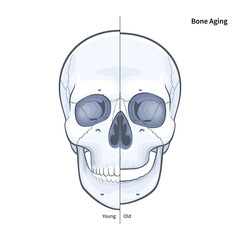 Young vs Old Skull Bone Aging illustration on white background