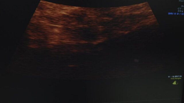3D Ultrasound of a Baby during the third Trimester