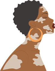 Afro-american woman illustration with vitiligo. World Vitiligo Day. Selfcare concept. Simple cartoon style