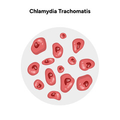 Chlamydia Trachomatis. Woman’s and man's reproductive system infections. Medical disease 