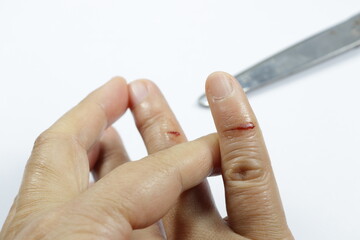 Red blood with cutting wound at the finger of woman hand isolated on white background. Accident from sharp metal concept. First aid and insurance.