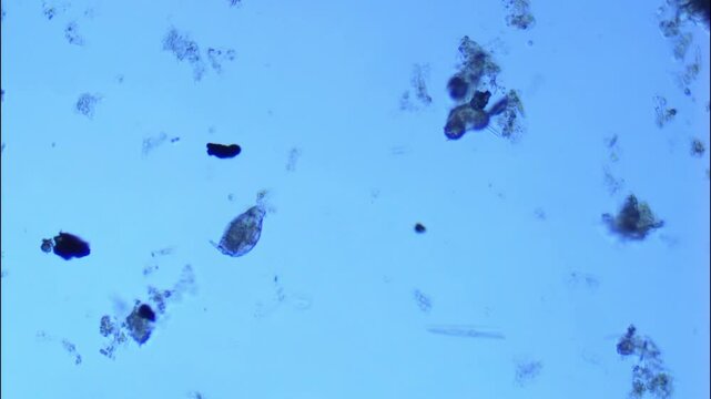 Freshwater rotifer defecates under microscope - 100x magnification