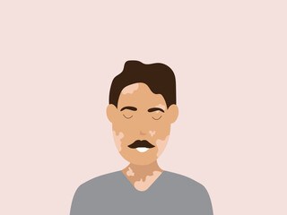 Portrait of a happy young man with vitiligo. Close up of man with skin disorder. male character with vitiligo. Vector illustration on isolated background.