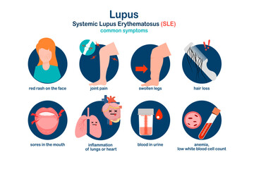 Flat medical illustration. Healthcare concept. Symptoms of Lupus or Systemic Lupus Erythematosus(SLE).