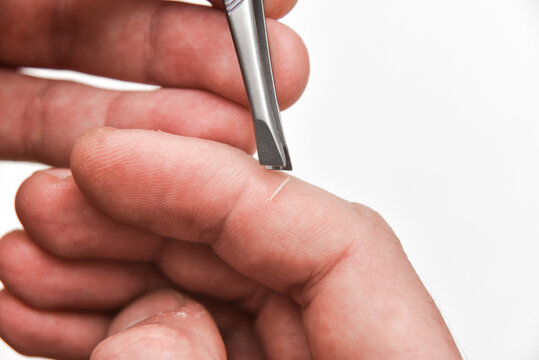 Getting a splinter out of a finger, close-up macro photo