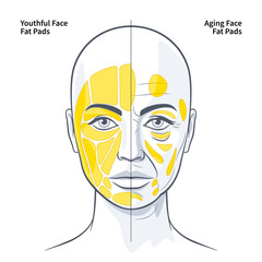 The Functional Anatomy of the Superficial Fat Pads Youthful and Aging Face illustration