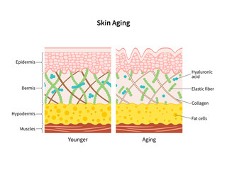 Skin aging process comparison of young and aged skin diagram illustration