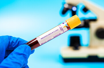 Immune marker Evaluates IgD levels, affected in cancers