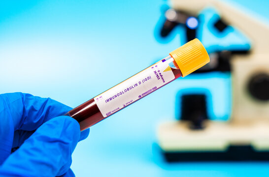 Immune marker Evaluates IgD levels, affected in cancers