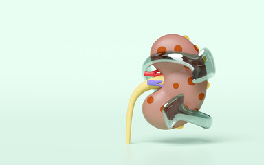 3d Chronic kidney disease or CKD with arrow isolated on green background. kidney disease prevention, world kidney day concept, 3d illustration render
