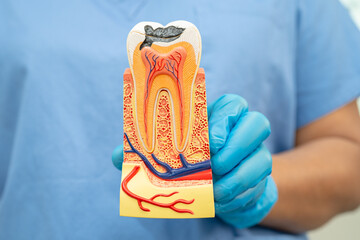 Dental implant, artificial tooth roots into jaw, root canal of dental treatment, gum disease, teeth...