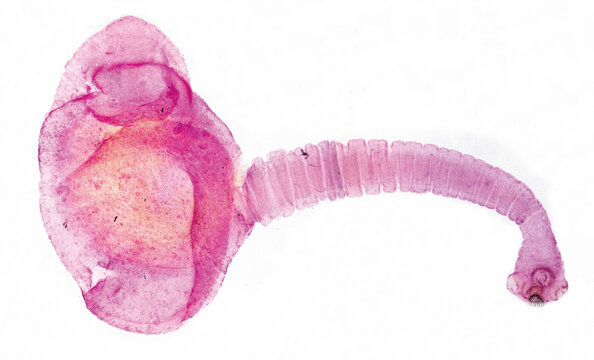 Porcine cysticercosis is the cysticercus of the tapeworm Taenia solium, which can parasitize the human brain, skin, and eyes, leading to the occurrence of diseases.Magnify 40x.