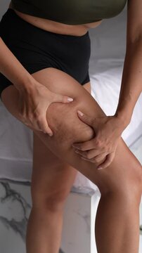 A young woman stands and squeezes the skin on her thigh with both hands revealing cellulite. Vertical shot focuses on the texture of her skin, emphasizing natural body features and self-care themes