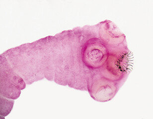 Cysticercus cellulosae is the cysticercus of Taenia solium, which can parasitize human brain, skin and eyes. This picture focuses on the scolex.Magnify 100x.
