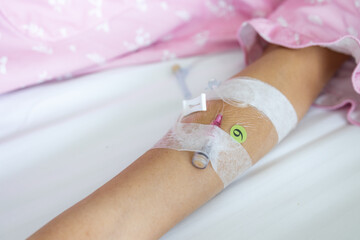 Closeup of patient arm with intravenous catheter