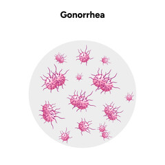 Gonorrhea. Human reproductive system transmitted infection virus bacterial