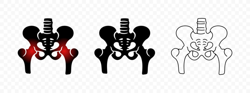 Pelvic bones or hip bone, hip inflammation in circle, orthopedic, graphic design. Healthcare, medicine, rheumatology and traumatology, vector design and illustration