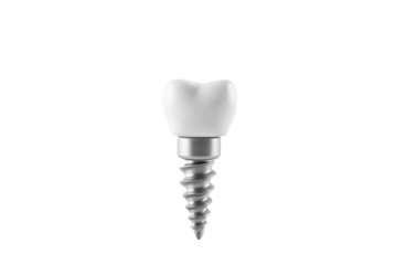 Dental Implant with White Ceramic Crown on Isolated Background