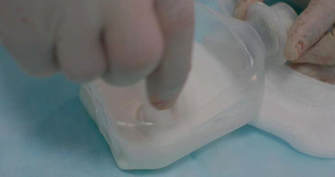 Veterinarian, wearing surgical gloves, carefully mixes bone cement in a container, preparing it for application in a procedure to fix broken vertebrae in an animal patient.