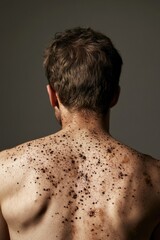 Naklejka premium Close-up of man with exfoliating back