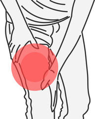 Woman with Leg Injury and Severe Thigh Pain