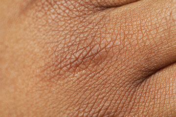 Fototapeta premium Macro view of normal skin as background