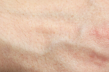 Fototapeta premium Texture of normal skin as background, closeup
