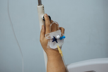 View of the hand of a patient with different tubes with vials for medicines and food.
