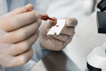 Scientist dripping blood sample onto glass slide in laboratory, closeup