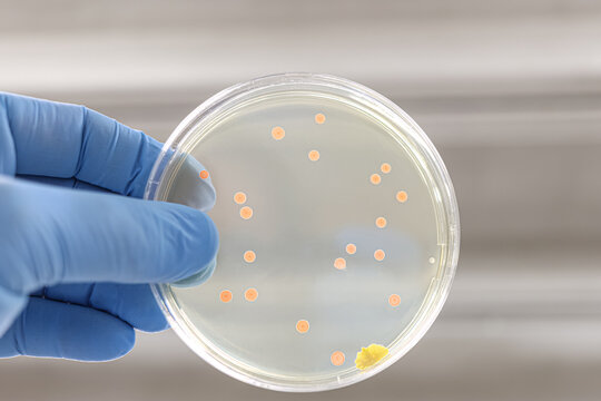 Blue glove of a doctor or researcher with a Petri dish containing orange colonies of bacteria. Space for text.