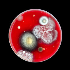 Mold fungi colonies grown from indoor air on blood sheep agar