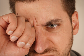 Obraz premium Young handsome male with beard and mustache scratching his eye. Allergy of dermatology problem concept.