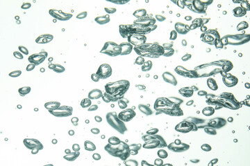 Many water bubbles on light background, closeup