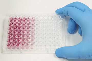 Hand with scientist's glove holding a multiwell plate for ELISA test. Diagnostic tests in the...