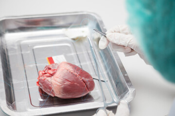 Heart surgery room with specialists providing care.