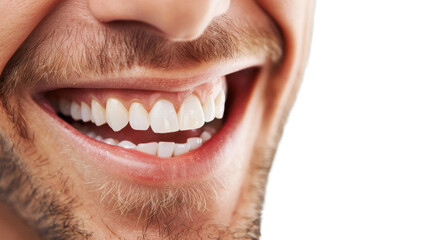 Close-up of man smiling showing healthy white teeth on transparent background