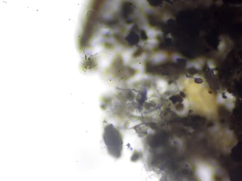 Plaster bagworm or Household moth larvae protective case under microscope
